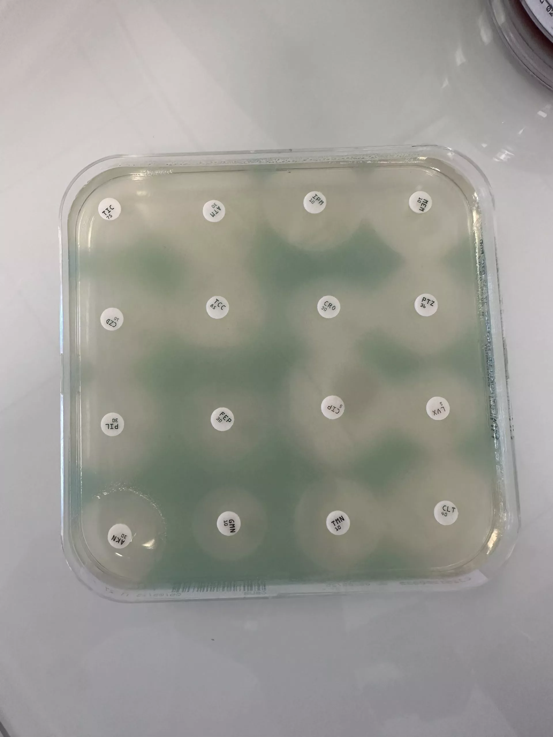 elfbar nachfüll pod läuft aus Diagnostic microbiologique de la pneumonie